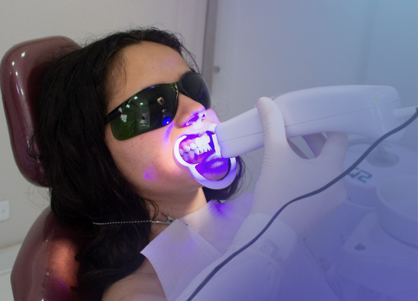 blanqueamientodental1