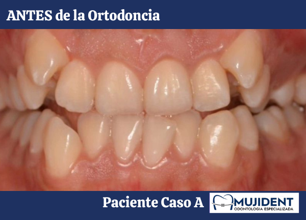 implantologia oral