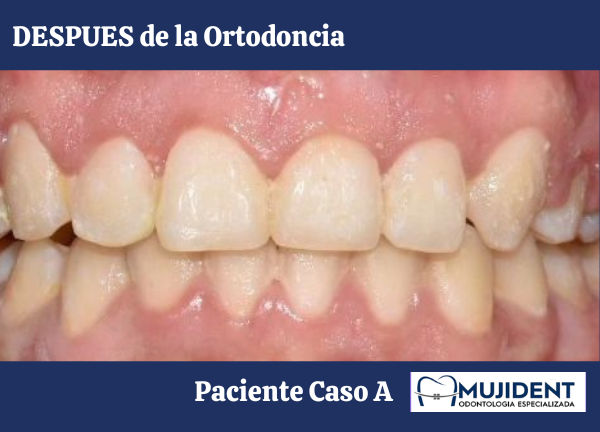 implantologia oral (2)